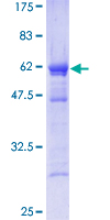 EF1B / EEF1B2 Protein - 12.5% SDS-PAGE of human EEF1B2 stained with Coomassie Blue