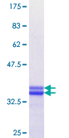 EF1B / EEF1B2 Protein - 12.5% SDS-PAGE Stained with Coomassie Blue.