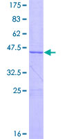 EFCAB11 / C14orf143 Protein - 12.5% SDS-PAGE of human C14orf143 stained with Coomassie Blue