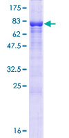 EFCAB14 Protein - 12.5% SDS-PAGE of human KIAA0494 stained with Coomassie Blue
