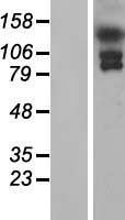 EFCAB6 Protein - Western validation with an anti-DDK antibody * L: Control HEK293 lysate R: Over-expression lysate