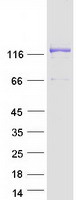EFCAB6 Protein - Purified recombinant protein EFCAB6 was analyzed by SDS-PAGE gel and Coomassie Blue Staining