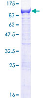 EFHC1 Protein - 12.5% SDS-PAGE of human EFHC1 stained with Coomassie Blue