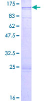 EFHC2 Protein - 12.5% SDS-PAGE of human EFHC2 stained with Coomassie Blue
