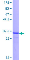 EFHD1 Protein - 12.5% SDS-PAGE Stained with Coomassie Blue.