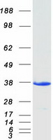 EFHD1 Protein - Purified recombinant protein EFHD1 was analyzed by SDS-PAGE gel and Coomassie Blue Staining