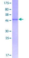 EFNA1 / Ephrin A1 Protein - 12.5% SDS-PAGE of human EFNA1 stained with Coomassie Blue