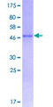 EFNA1 / Ephrin A1 Protein - 12.5% SDS-PAGE of human EFNA1 stained with Coomassie Blue