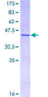 EFNA1 / Ephrin A1 Protein - 12.5% SDS-PAGE Stained with Coomassie Blue