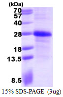 EFNA1 / Ephrin A1 Protein