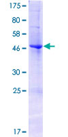 EFNA2 / Ephrin A2 Protein - 12.5% SDS-PAGE of human EFNA2 stained with Coomassie Blue