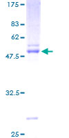 EFNA3 / Ephrin A3 Protein - 12.5% SDS-PAGE of human EFNA3 stained with Coomassie Blue