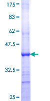 EFNA3 / Ephrin A3 Protein - 12.5% SDS-PAGE Stained with Coomassie Blue