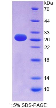 EFNA3 / Ephrin A3 Protein - Recombinant  Ephrin A3 By SDS-PAGE