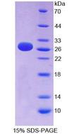 EFNA3 / Ephrin A3 Protein - Recombinant  Ephrin A3 By SDS-PAGE