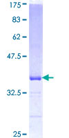 EFNA5 / Ephrin A5 Protein - 12.5% SDS-PAGE Stained with Coomassie Blue.