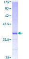 EFNA5 / Ephrin A5 Protein - 12.5% SDS-PAGE Stained with Coomassie Blue.
