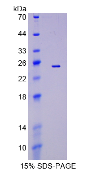 EFNA5 / Ephrin A5 Protein - Recombinant  Ephrin A5 By SDS-PAGE