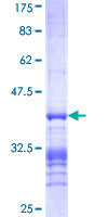 EFNB1 / Ephrin B1 Protein - 12.5% SDS-PAGE Stained with Coomassie Blue.