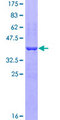 EFNB2 / Ephrin B2 Protein - 12.5% SDS-PAGE Stained with Coomassie Blue