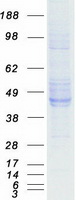 EFNB2 / Ephrin B2 Protein - Purified recombinant protein EFNB2 was analyzed by SDS-PAGE gel and Coomassie Blue Staining