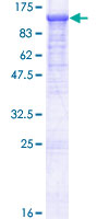 EFR3A Protein - 12.5% SDS-PAGE of human EFR3A stained with Coomassie Blue