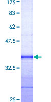 EFS / CASS3 Protein - 12.5% SDS-PAGE Stained with Coomassie Blue.