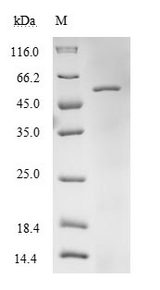 EFTU / TUFM Protein - (Tris-Glycine gel) Discontinuous SDS-PAGE (reduced) with 5% enrichment gel and 15% separation gel.