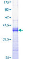 EGF Protein - 12.5% SDS-PAGE Stained with Coomassie Blue