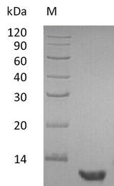 EGF Protein - (Tris-Glycine gel) Discontinuous SDS-PAGE (reduced) with 5% enrichment gel and 15% separation gel.