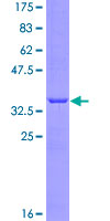 EGFL6 Protein - 12.5% SDS-PAGE Stained with Coomassie Blue.