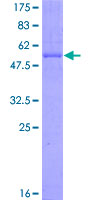 EGFL7 Protein - 12.5% SDS-PAGE of human EGFL7 stained with Coomassie Blue