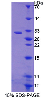 EGFL7 Protein - Recombinant  EGF Like Domain Protein, Multiple 7 By SDS-PAGE