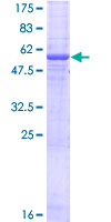 EGFL8 / NG3 Protein - 12.5% SDS-PAGE of human EGFL8 stained with Coomassie Blue