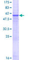 EGFL8 / NG3 Protein - 12.5% SDS-PAGE of human EGFL8 stained with Coomassie Blue