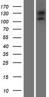 EGFLAM Protein - Western validation with an anti-DDK antibody * L: Control HEK293 lysate R: Over-expression lysate