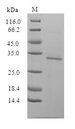 EGFP Protein - (Tris-Glycine gel) Discontinuous SDS-PAGE (reduced) with 5% enrichment gel and 15% separation gel.