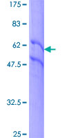 EGFR Protein - 12.5% SDS-PAGE of human EGFR stained with Coomassie Blue