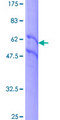 EGFR Protein - 12.5% SDS-PAGE of human EGFR stained with Coomassie Blue