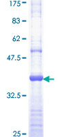 EGFR Protein - 12.5% SDS-PAGE Stained with Coomassie Blue.
