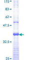 EGFR Protein - 12.5% SDS-PAGE Stained with Coomassie Blue.