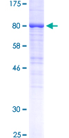 EGFR Protein - 12.5% SDS-PAGE Stained with Coomassie Blue.