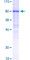 EGFR Protein - 12.5% SDS-PAGE Stained with Coomassie Blue.