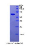 EGFR Protein - Recombinant Epidermal Growth Factor Receptor By SDS-PAGE