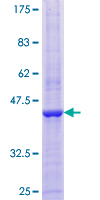 EGLN1 / PHD2 Protein - 12.5% SDS-PAGE of human EGLN1 stained with Coomassie Blue