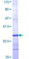 EGLN1 / PHD2 Protein - 12.5% SDS-PAGE Stained with Coomassie Blue.
