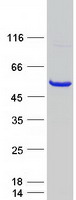 EGLN1 / PHD2 Protein - Purified recombinant protein EGLN1 was analyzed by SDS-PAGE gel and Coomassie Blue Staining