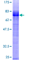 EGLN2 / PHD1 Protein - 12.5% SDS-PAGE of human EGLN2 stained with Coomassie Blue