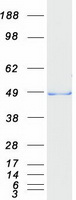 EGLN2 / PHD1 Protein - Purified recombinant protein EGLN2 was analyzed by SDS-PAGE gel and Coomassie Blue Staining
