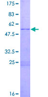 EGLN3 / PHD3 Protein - 12.5% SDS-PAGE of human EGLN3 stained with Coomassie Blue